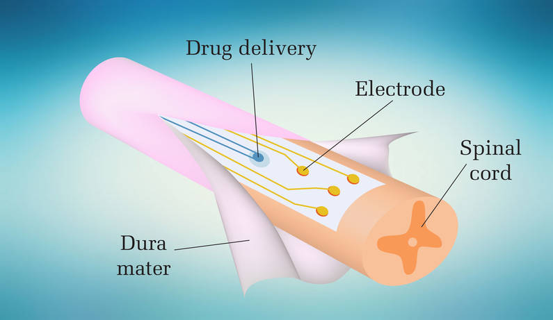 Biomaterials. Electronic dura mater for long-term multimodal neural interfaces.